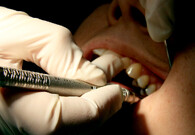 Vrátní zubů