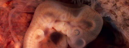 Lidské, sedm týdnů staré embry Foto: euthman/ Flickr