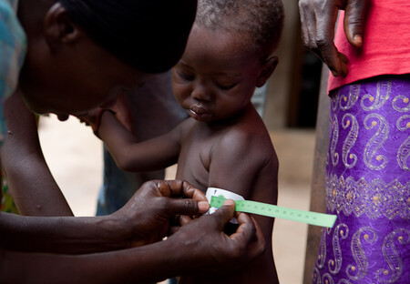 Zdravotnice pomocí pásky kontroluje, zda dítě netrpí podvýživou