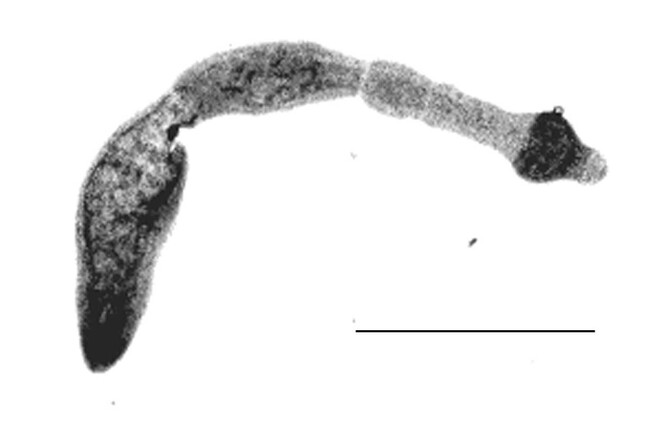 Dospělý jedinec Echinococcus multilocularis izolovaný z lišky, Maďarsko. Měřítko