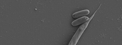 Parazitický prvok Blastocrithidia nonstop Foto: AV ČR