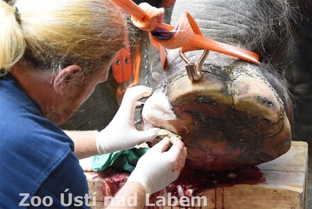 Cílem zákroku bylo zabránit postupujícímu rozpadu článků prstů, odstranit patologickou tkáň v chodidle a zabránit opakujícím se, silně bolestivým stavům.