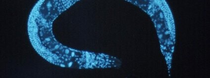 Hlíst druhu Caenorhabditis elegan. Foto: National Human Genome Research Institute  4