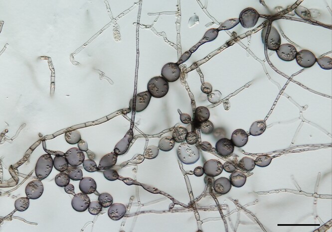 Houba Thalassodendromyces purpureus tvoří tzv. monilioidní hyfy v čisté kultuře. Ty se skládají z kulovitých buněk, které připomínají korálky navlečené na šňůrce (měřítko 50 µm).