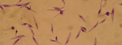 Leishmanie - původce leishmaniózy Foto: Abanima Wikimedia Commons