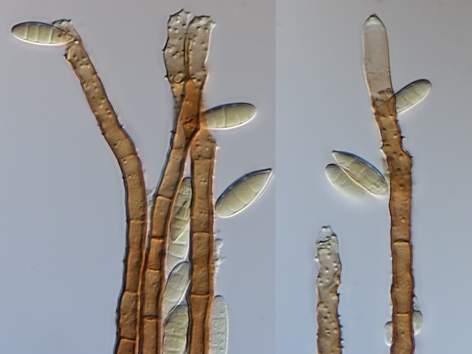 Pleurophragmium parvisporum pod mikroskopem.