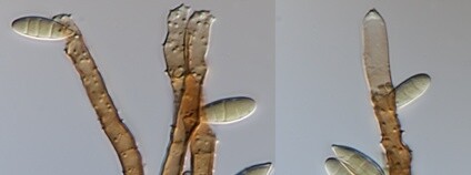 Pleurophragmium parvisporum pod mikroskopem. Foto: M. Réblová Botanický ústav AV ČR