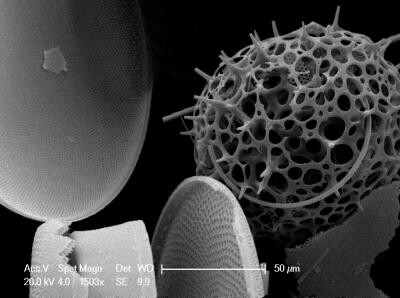 Kvůli rostoucím průměrným teplotám se snižuje schopnost oceánů zachycovat uhlík. Plankton pod elektronickým mikroskopem