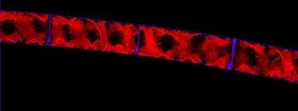 Spirogyra Foto: V. Schmidt AVČR