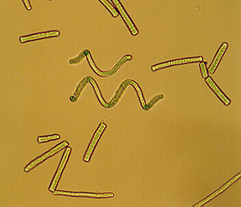 Není to žádný lék ani zázračný prostředek, je to ale potravina bohatá na proteiny a antioxidanty. Díky obsahu chlorofylu má detoxikační účinek a díky fykokyaninu také účinek protizánětlivý