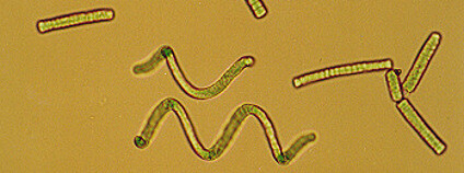 Spirulina Foto: Joan Simon / Wikipedia Commons