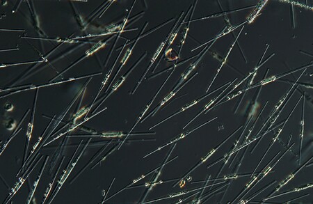 Mikroskopický snímek rozsivek (jde o ilustrační foto, nejedná se o konkrétní druh výše zmiňované rozsivky Pseudo-nitzschia multiseries).