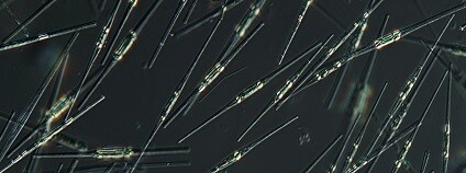 foto: Petr Znachor / Biologické centrum AV ČR