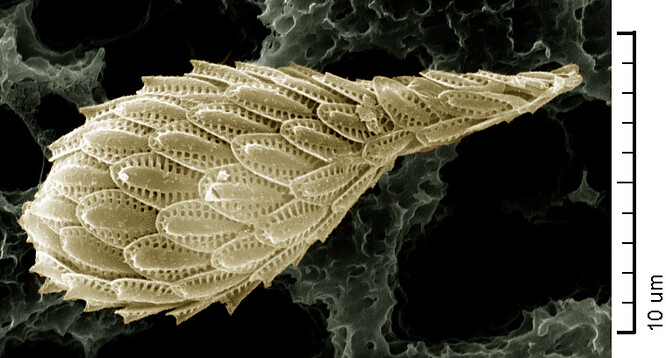 Řasa Synura petersenii, která náleží do skupiny zlativek, je běžnou součástí planktonu jezer v mírných zeměpisných šířkách.