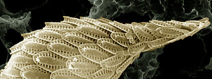 Řasa Synura petersenii Foto: Drew Lindow Wikimedia Commons