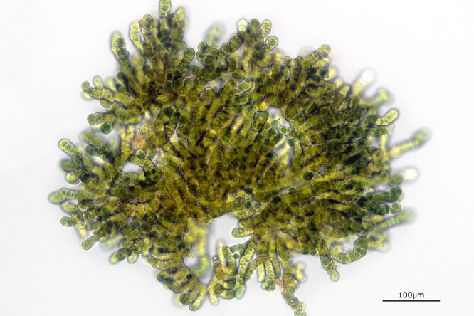 Mikroskopický snímek toxické sinice Aetokthonos, tvořící dolastatiny.