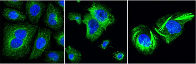 Účinek dolastatinů na rakovinné buňky: zleva cytoskelet nepoškozených rakovinných buněk v kultuře, uprostřed cytoskelet rakovinných buněk poškozený dolastatiny ze sinic, vpravo srovnání s účinkem známého cytostatika taxolu z tisu červeného.