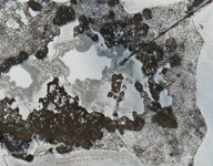 Sekání rákosu na zamrzlém rybníce