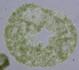Sinice Microcystis: kolonie pod mikroskopem. Jedna kolonie sdružuje ve slizu až desetitisíce buněk.