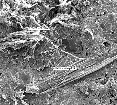 Rakovina způsobená mikroskopickými vlákny azbestu má tu vlastnost, že se může projevit až velmi dlouho po té, co se člověk vláken nadýchal – třeba až čtyřicet let po té. Na mikroskopickém snímku vlákna azbestu.