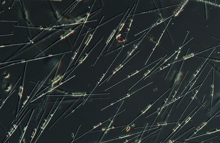 Mikroskopický snímek rozsivek (jde o ilustrační foto, nejedná se o konkrétní druh výše zmiňované rozsivky Pseudo-nitzschia multiseries).